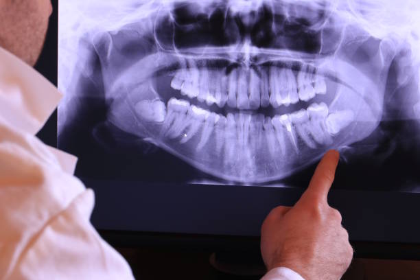 Best Urgent Tooth Repair  in Eagle, NE